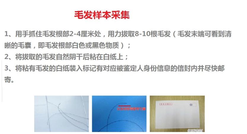 胎儿流产物亲子鉴定能做